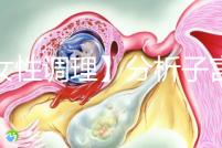 【女性調理】分析子宮壁薄的四個常見原因，教你三招對癥下藥可以快速改善！