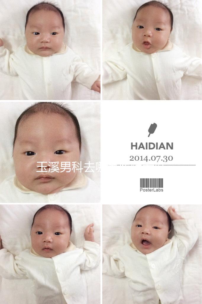 玉溪男科去哪家醫(yī)院看好，怎么選攻略，這個排行榜不要錯過