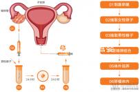 玉溪到昆華醫院做試管嬰兒怎么樣?詳細費用明細如下