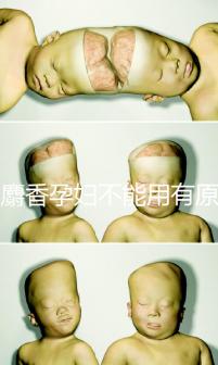 白麝香孕婦不能用有原因,流產、早產…這些危害不得不知