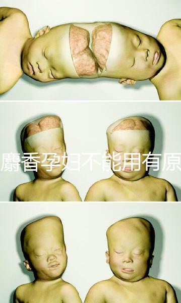 白麝香孕婦不能用有原因，流產(chǎn)、早產(chǎn)…這些危害不得不知