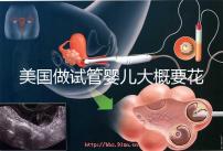 美國(guó)做試管嬰兒大概要花多少錢?具體支出25w!