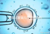美國(guó)試管嬰兒安全可靠嗎?了解基本原理和安全性?