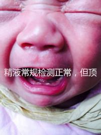 精液常規(guī)檢測正常，但頂體酶低，是否影響試管嬰兒成功率？