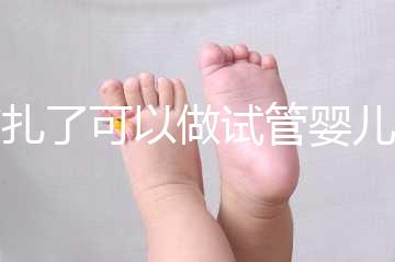 結扎了可以做試管嬰兒嗎(女性結扎了可以做試管嬰兒嗎)