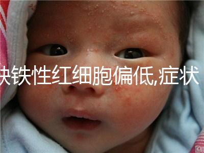 缺鐵性紅細胞偏低,癥狀多以精神萎靡為多