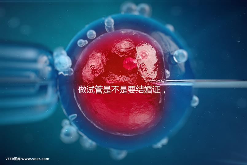 做試管是不是要結婚證，做試管需要結婚證