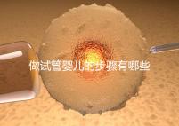 做試管嬰兒的步驟有哪些(做試管嬰兒的步驟有哪些方法)
