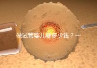 做試管嬰兒要多少錢？一起算筆經濟賬