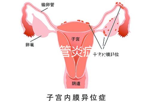 反流性食管炎癥狀(反流性食管炎癥狀有哪些反應)