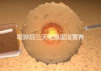 取卵后三天吃泡面沒(méi)營(yíng)養(yǎng)?3個(gè)小妙招“變廢為寶”