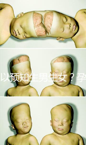 可以預(yù)知生男生女？孕婦夢見馬的胎夢解讀