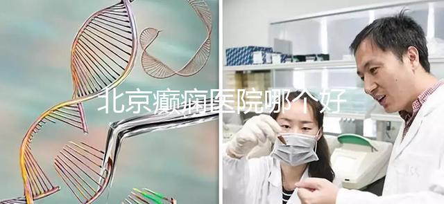 北京癲癇醫(yī)院哪個好