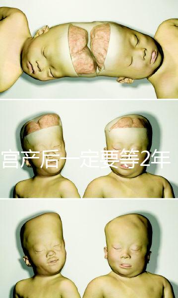 剖宮產(chǎn)后一定要等2年，才能試管嬰兒懷孕嗎？