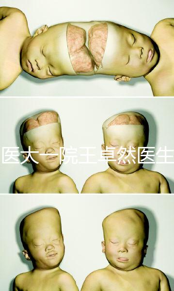 哈醫(yī)大一院王卓然醫(yī)生試管攻略,坐診時間、成功率早知道