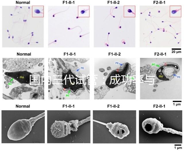 國(guó)內(nèi)三代試管：成功率與費(fèi)用全知曉？
