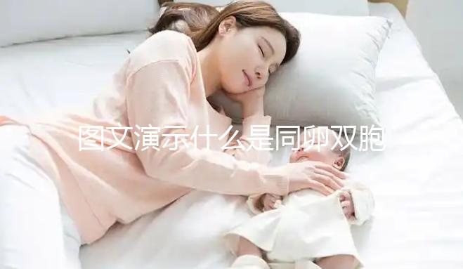 圖文演示什么是同卵雙胞胎,和異卵雙胞胎有3大區(qū)別