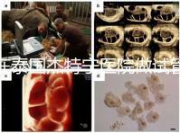 在泰國杰特寧醫(yī)院做試管嬰兒的費(fèi)用明細(xì)和醫(yī)院排名清單,輕松規(guī)劃你的試管旅程!