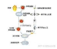 何猷君求婚成功！賭王四太回應“奚夢瑤懷孕”傳聞
