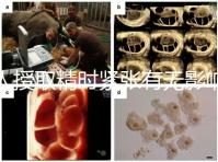 人授取精時緊張有無影響別還不造，注意事項不少不可不知