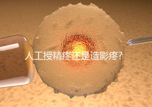 人工授精疼還是造影疼?被瞎對比，二者疼痛不是一個等級