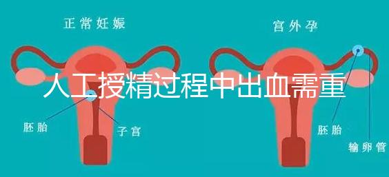 人工授精過程中出血需重視！這3種情況會影響成功率