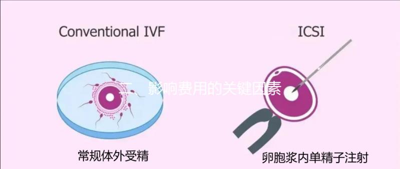 二、影響費用的關(guān)鍵因素