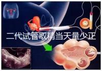 二代試管取精當天量少正不正常60s弄清，不造怎么辦速覽