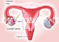 不清楚女女結婚哪個國家能領證來看，歐洲這些地區都可