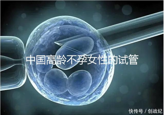 中國高齡不孕女性的試管嬰兒指南,8個(gè)方面5條推薦意見