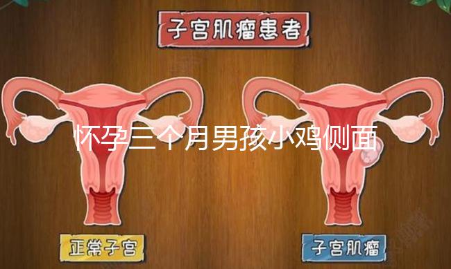 懷孕三個(gè)月男孩小雞側(cè)面二維b超圖片分享,原來兩腿間有尖