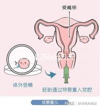 打了艾澤250ug幾天能代謝完戳，第十天別還不敢走下一步