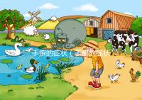 手癬的癥狀(手癬的癥狀有哪些?)