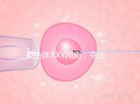 染色體XXY鬧劇：克氏綜合征，帶你走進“第三性別”群體