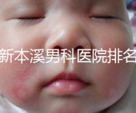 更新本溪男科醫院排名，不要錯過本溪湖區top3醫生的專業