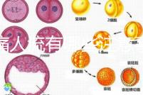 無痛人流有哪些注意事項？