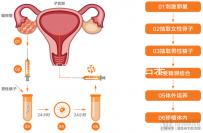 無性婚姻做試管嬰兒后來怎么樣?三個大案例揭開了內(nèi)幕