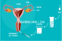 正規試管嬰兒醫院(正規試管嬰兒醫院排名)