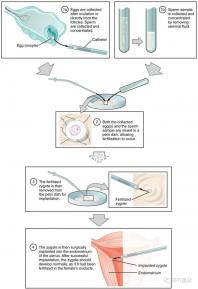 武漢四維彩超費用表整理,內附市婦保院超全預約攻略