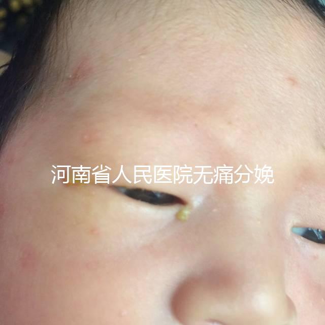 河南省人民醫院無痛分娩多少錢戳，收費標準60s看懂不踩坑