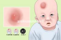 淄博男科醫(yī)院排名表來了2024年哪個口碑好？網(wǎng)友怎么說？