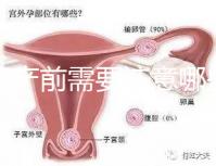孕婦產前需要注意哪些事項？