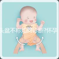頭盆不稱如何診斷?懷孕9月查出頭盆不稱，是順還是剖