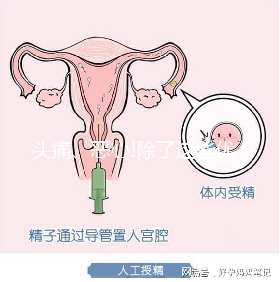 頭痛、惡心!除了這些優思明副作用還有哪些