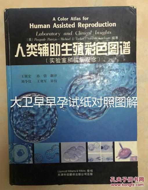 大衛早早孕試紙對照圖解，教你怎么看結果是不是陽性