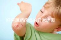 妊娠早期疼痛的異常表現是什么？