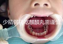 少精弱精吃麒麟丸需謹慎!千萬別忽視這4大副作用