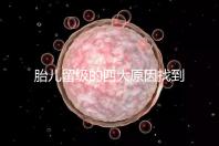 胎兒留級的四大原因找到了！多半和媽媽太懶不運(yùn)動(dòng)有關(guān)系