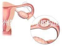 蘇州第三代助孕機構(gòu)正規(guī)可靠嗎？實地考察才為真