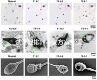 試管促排卵不同方案都適合哪些人?如何監(jiān)測(cè)排卵?